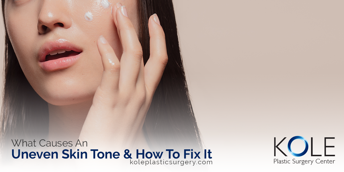 what-causes-an-uneven-skin-tone-how-to-fix-it-kole-plastic-surgery