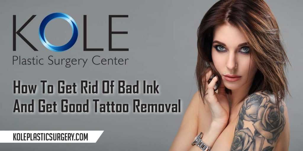 How To Get Rid Of Bad Ink And Get Great Tattoo Removal