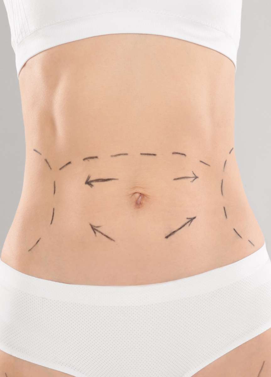 Liposuction in Southampton, PA