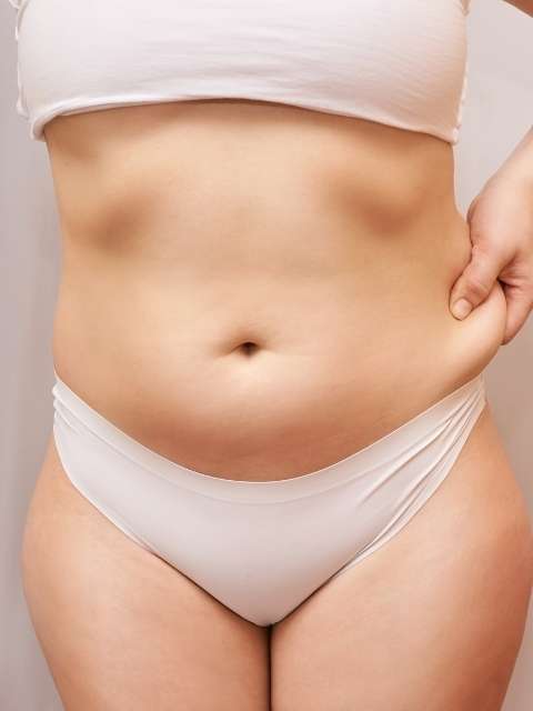 Mini Tummy Tuck Results  Cosmetic Plastic Surgery Institute