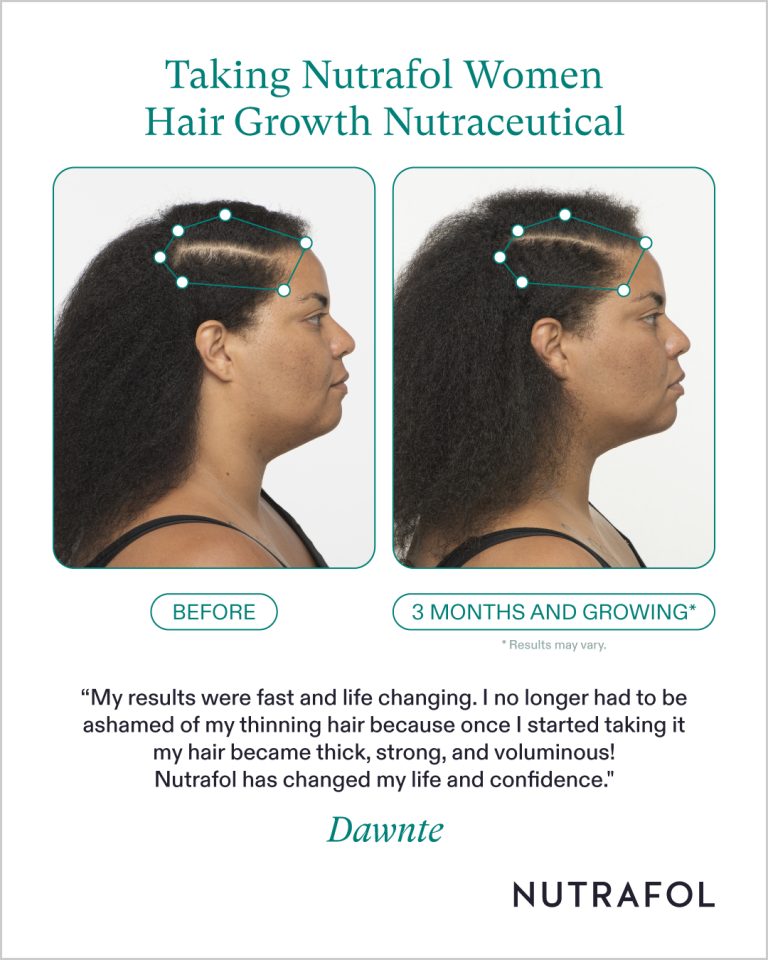 Nutrafol_126279_Pro_Before_After_Photos_Ad_Templates
Before and After